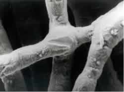 Sintered Metal Joint